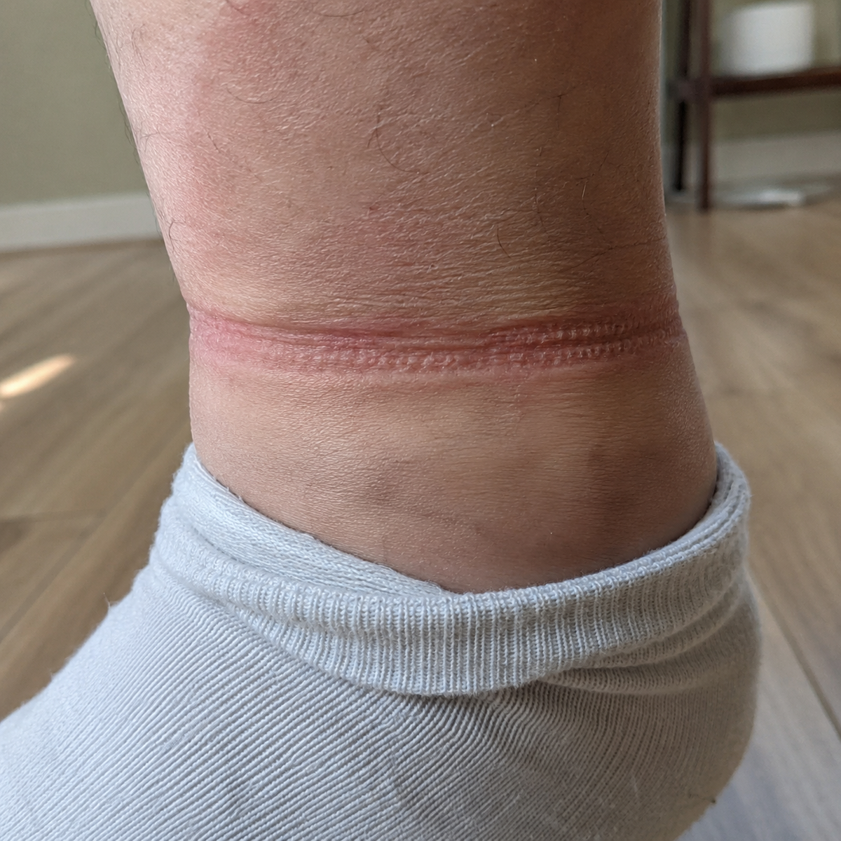 Ordinary ankle sock cuff
