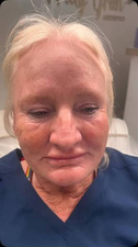 Janette M., 49
